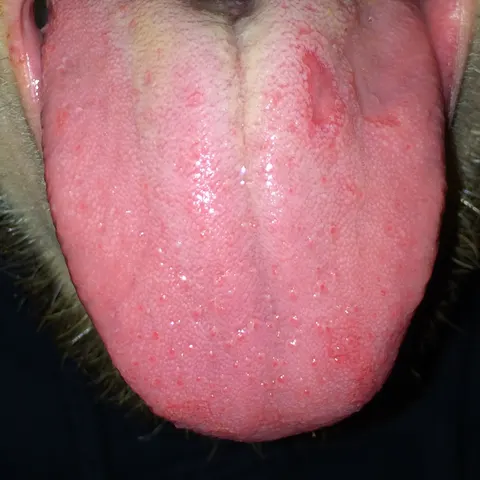 Tongue with one small smooth patch near the back on one side