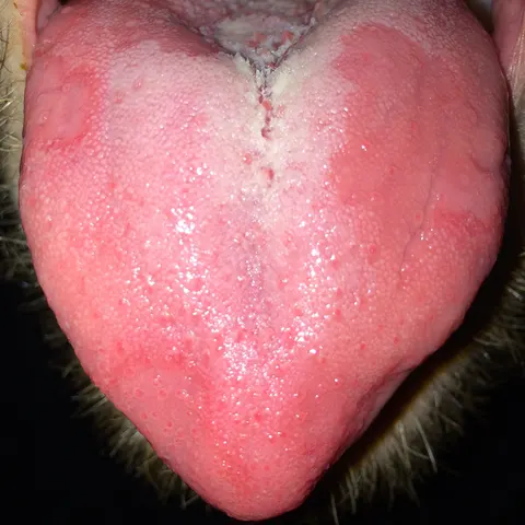 The same tongue on day six: the first patch has faded and a new one has formed on the other side